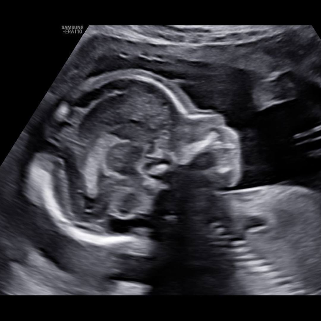 Photo shared by Jose for their Babylist baby registry.