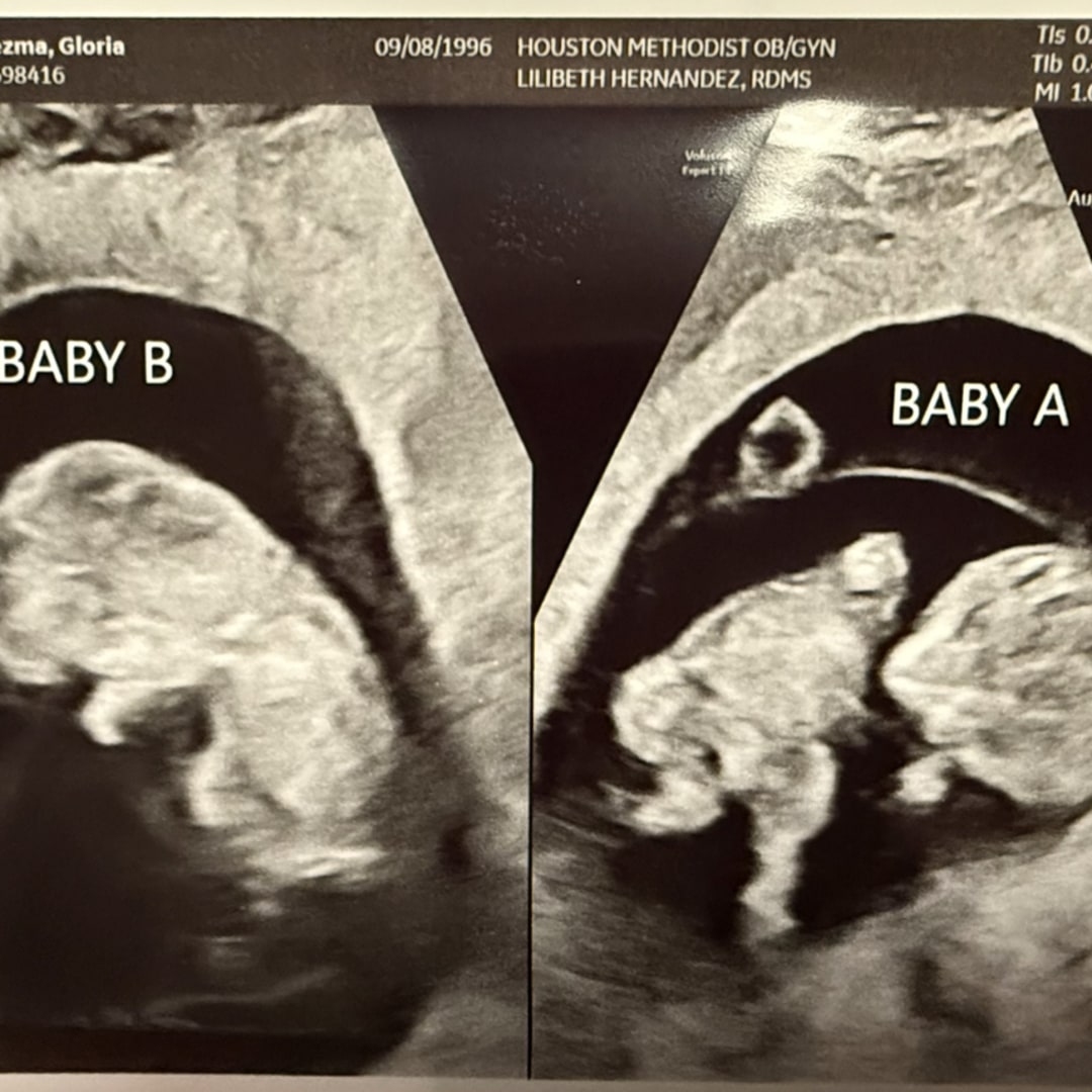 Photo shared by Gloria for their Babylist baby registry.