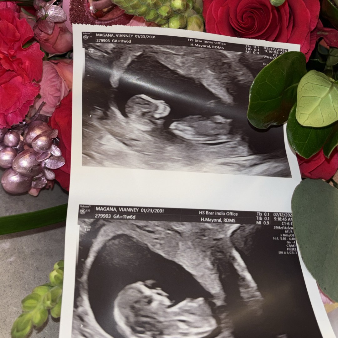 Photo shared by Vianney for their Babylist baby registry.