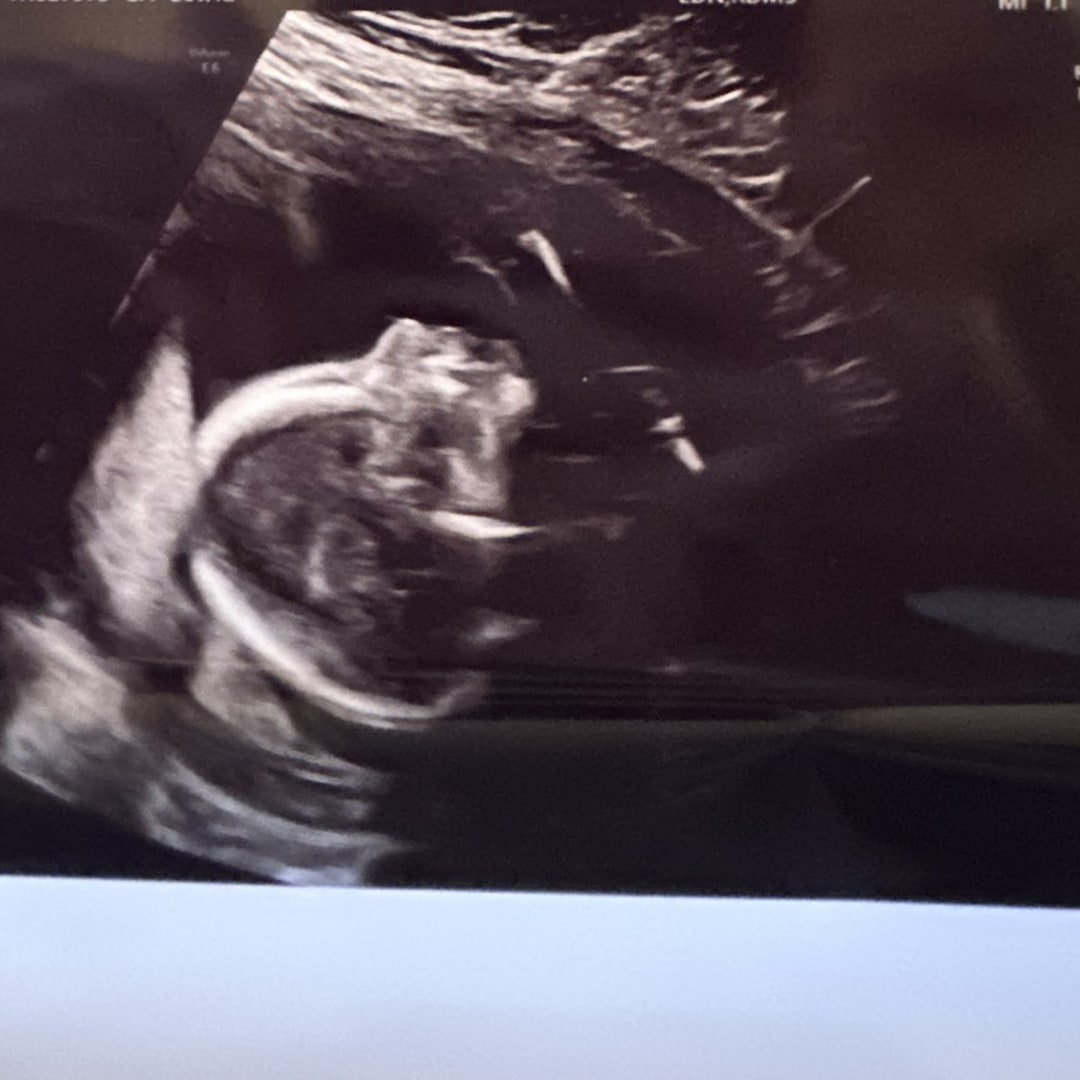 Photo shared by Starla for their Babylist baby registry.