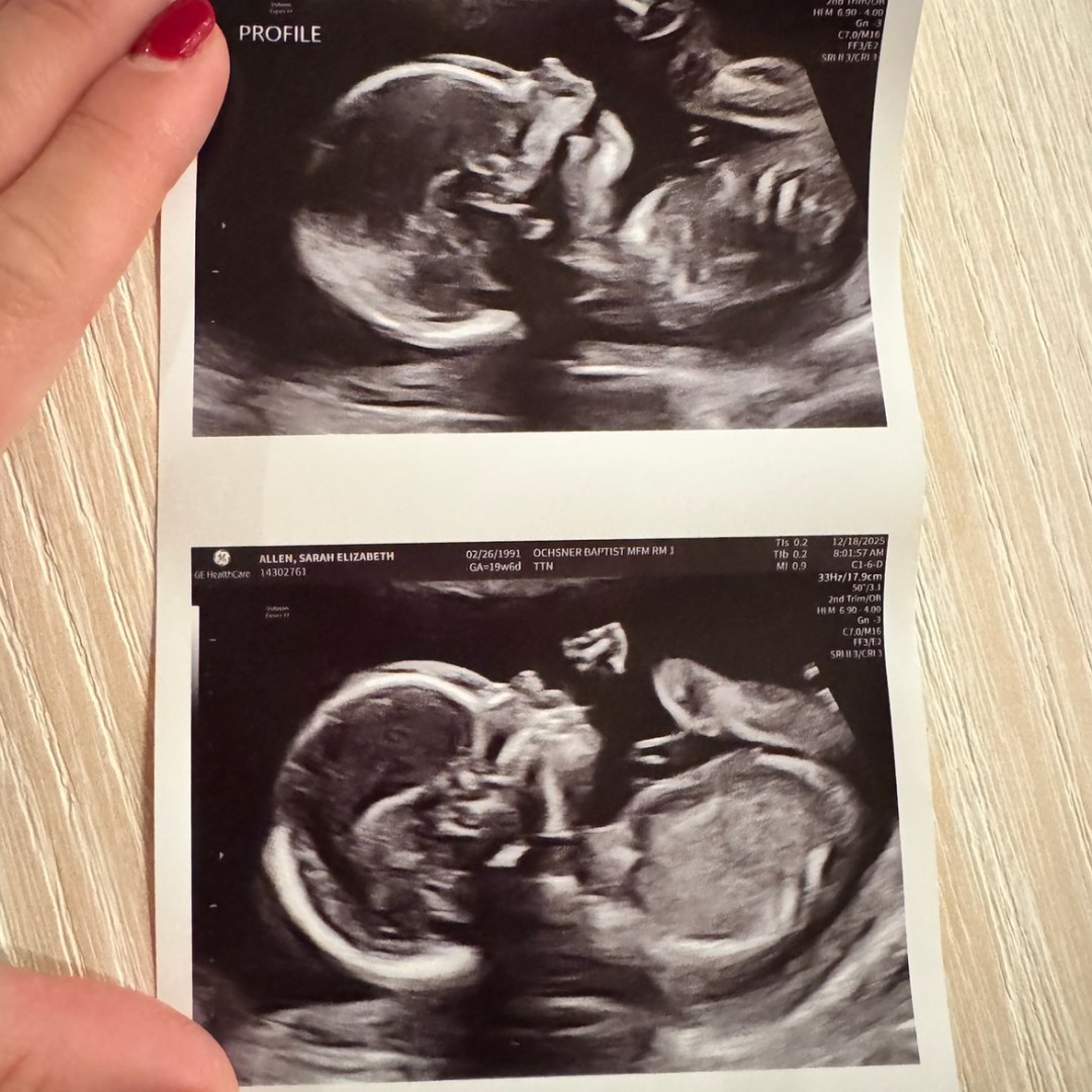 Photo shared by Sarah for their Babylist baby registry.