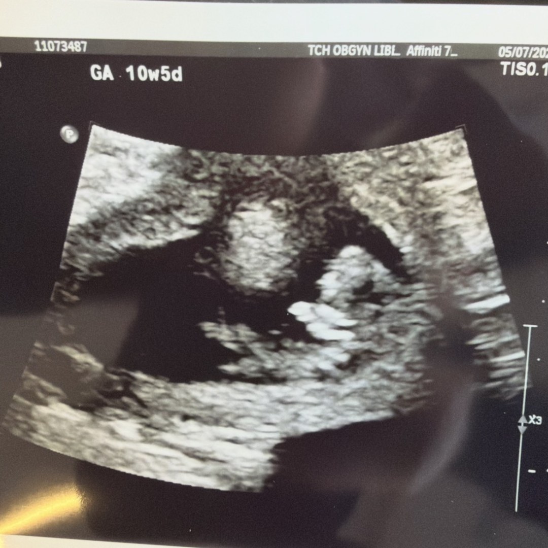 Photo shared by Jamie for their Babylist baby registry.