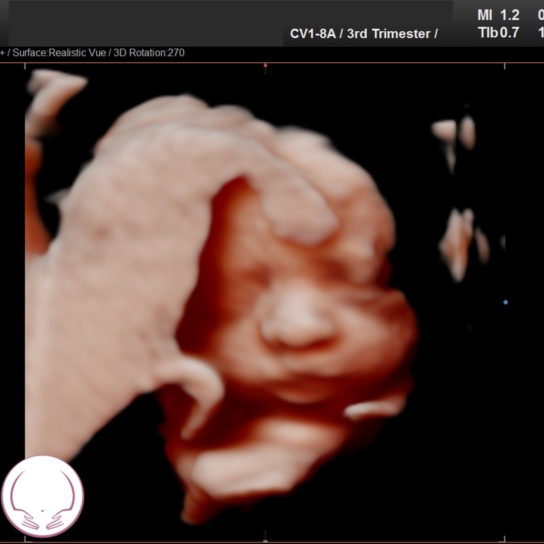 Photo shared by Sydney for their Babylist baby registry.