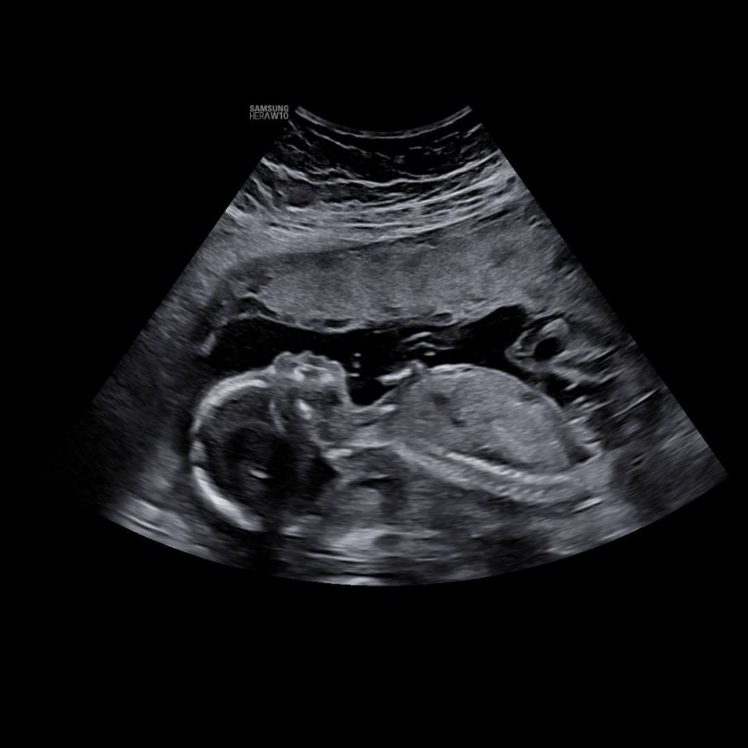 Photo shared by Taylor for their Babylist baby registry.