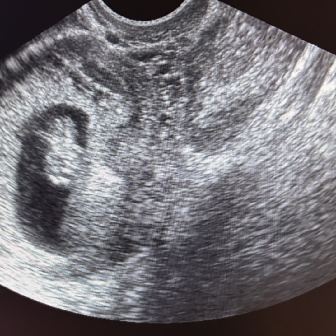 Photo shared by Alina for their Babylist baby registry.