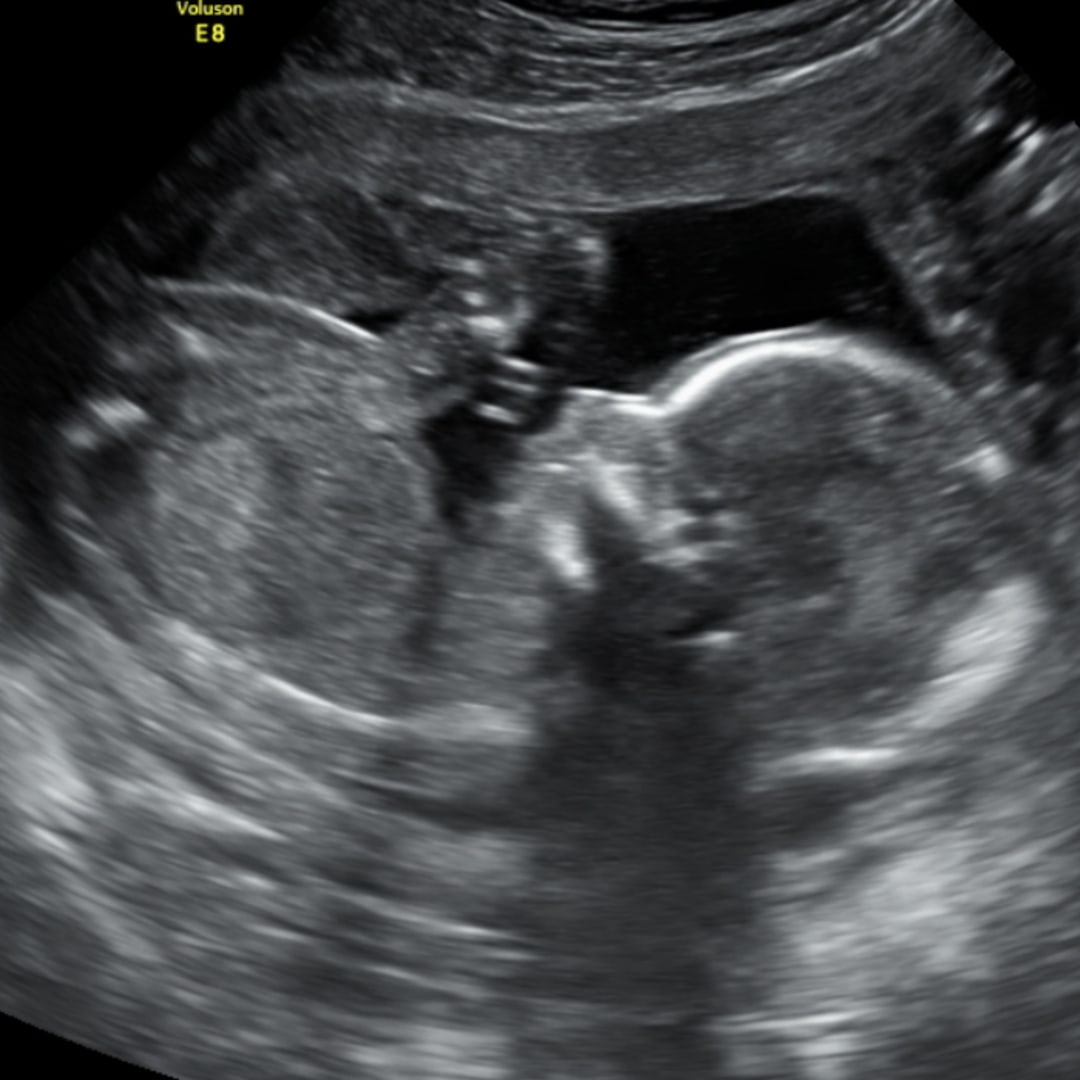 Photo shared by Alyssa for their Babylist baby registry.