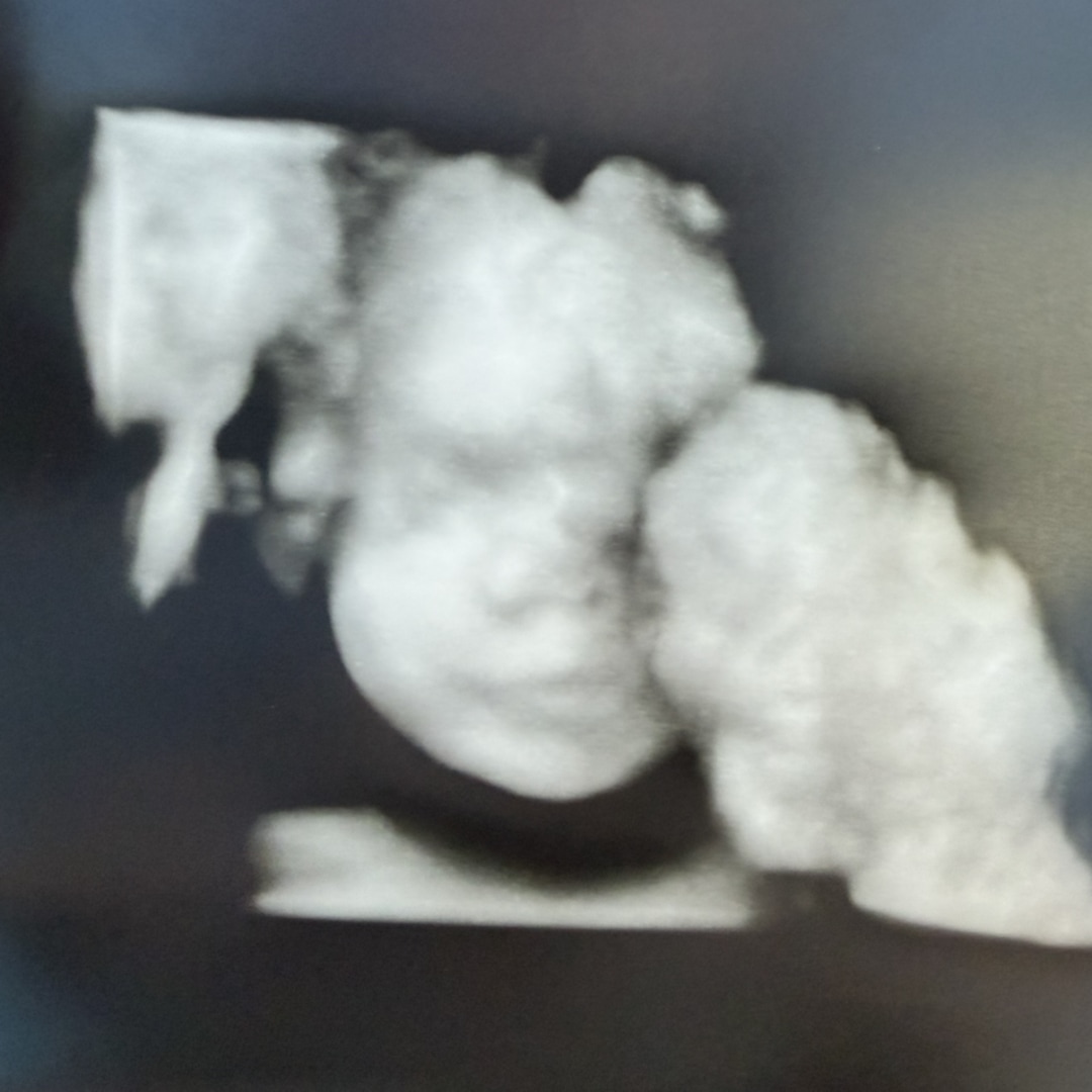 Photo shared by Ashlynn for their Babylist baby registry.