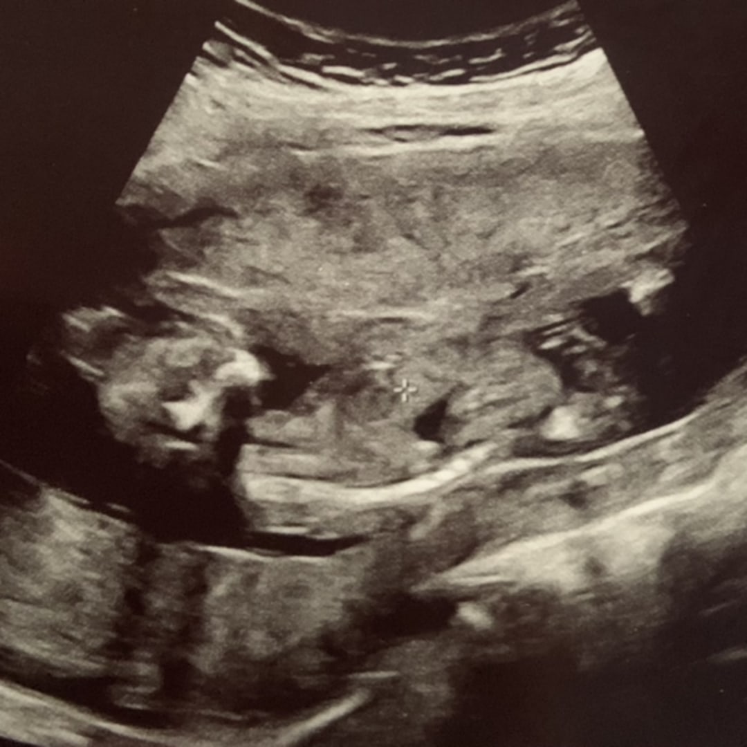 Photo shared by Alyesha for their Babylist baby registry.