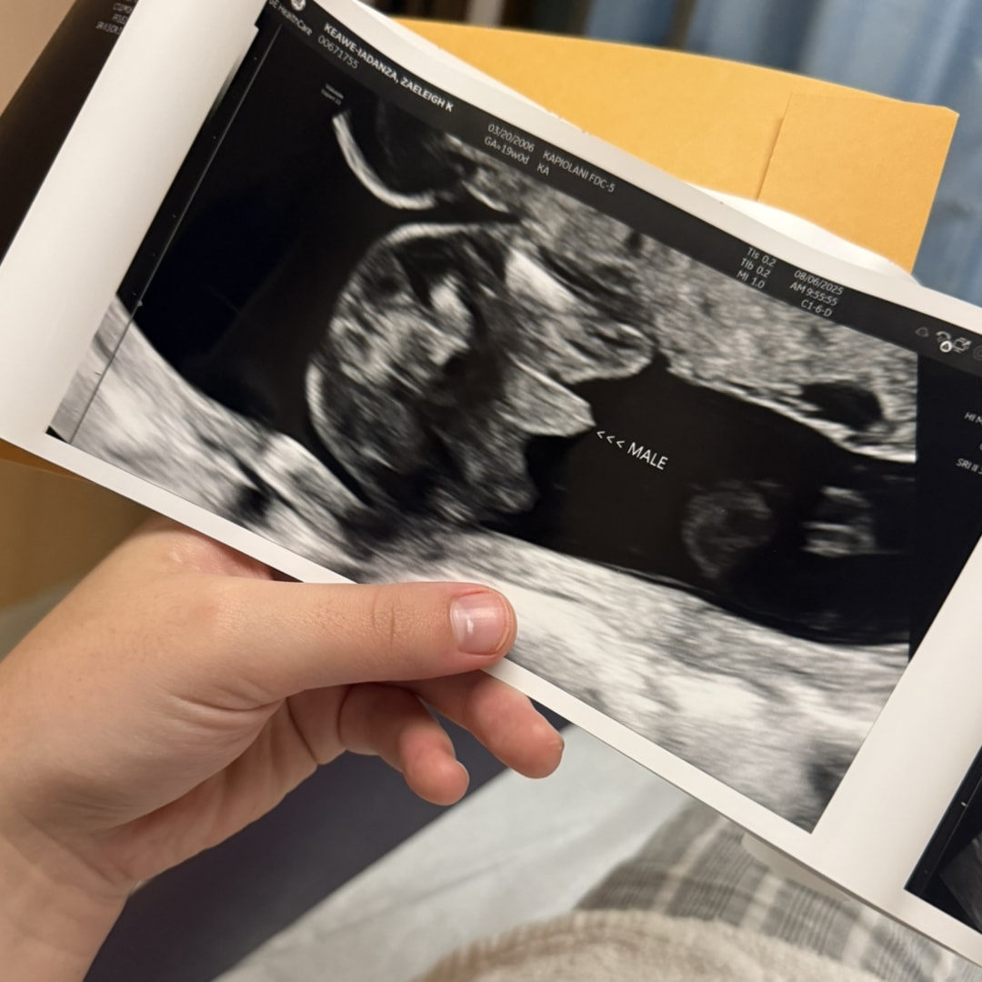 Photo shared by Zaeleigh for their Babylist baby registry.