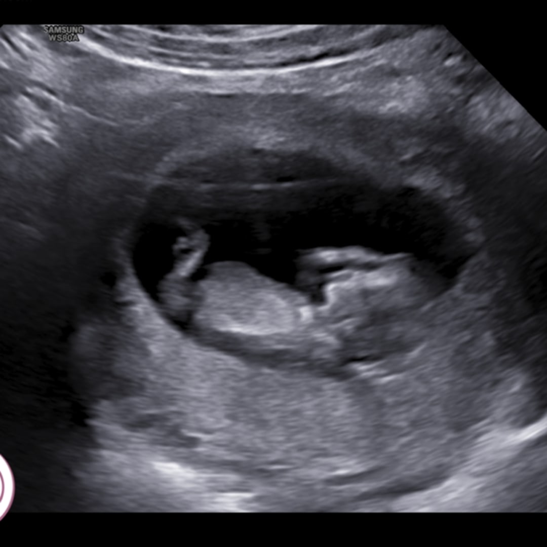 Photo shared by Baylee for their Babylist baby registry.