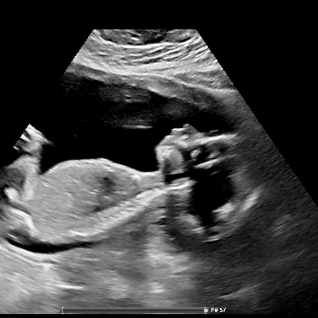 Photo shared by Alyssa for their Babylist baby registry.