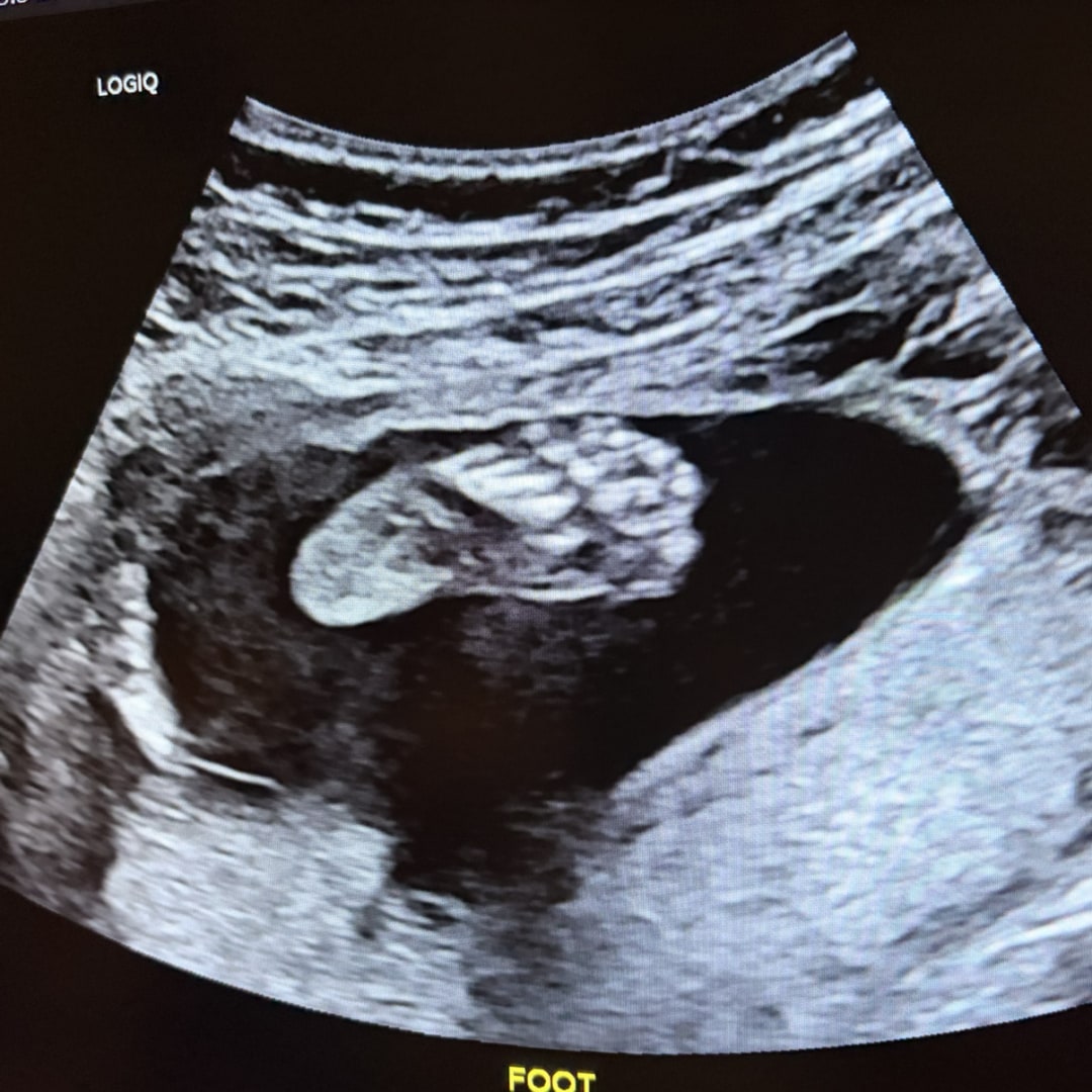 Photo shared by Brittany for their Babylist baby registry.