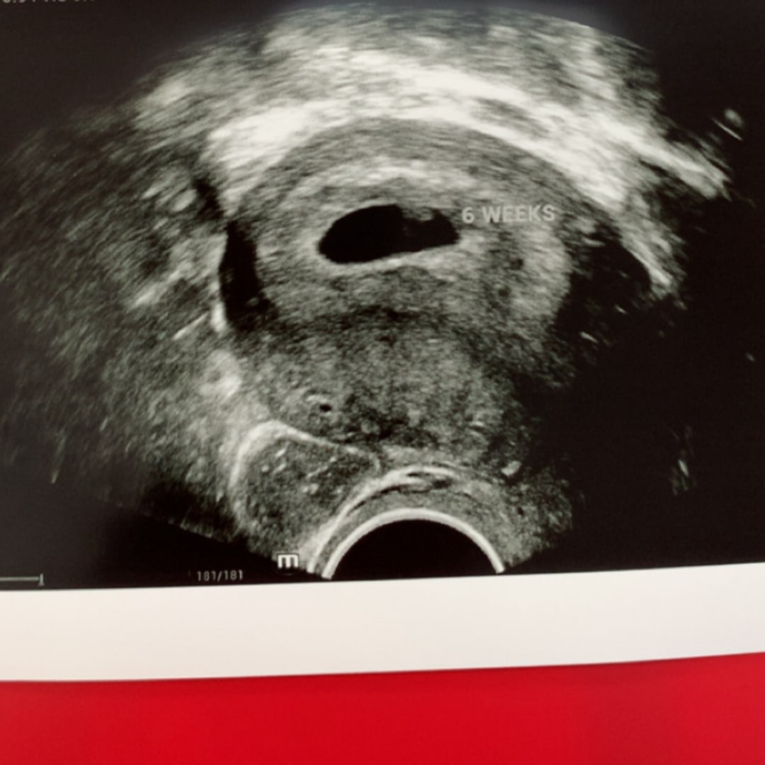 Photo shared by Kamryn for their Babylist baby registry.