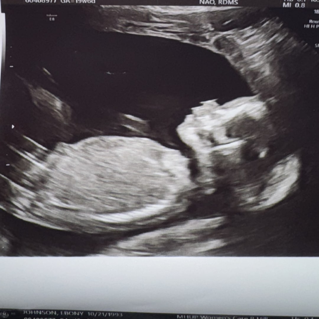 Photo shared by Ebony for their Babylist baby registry.