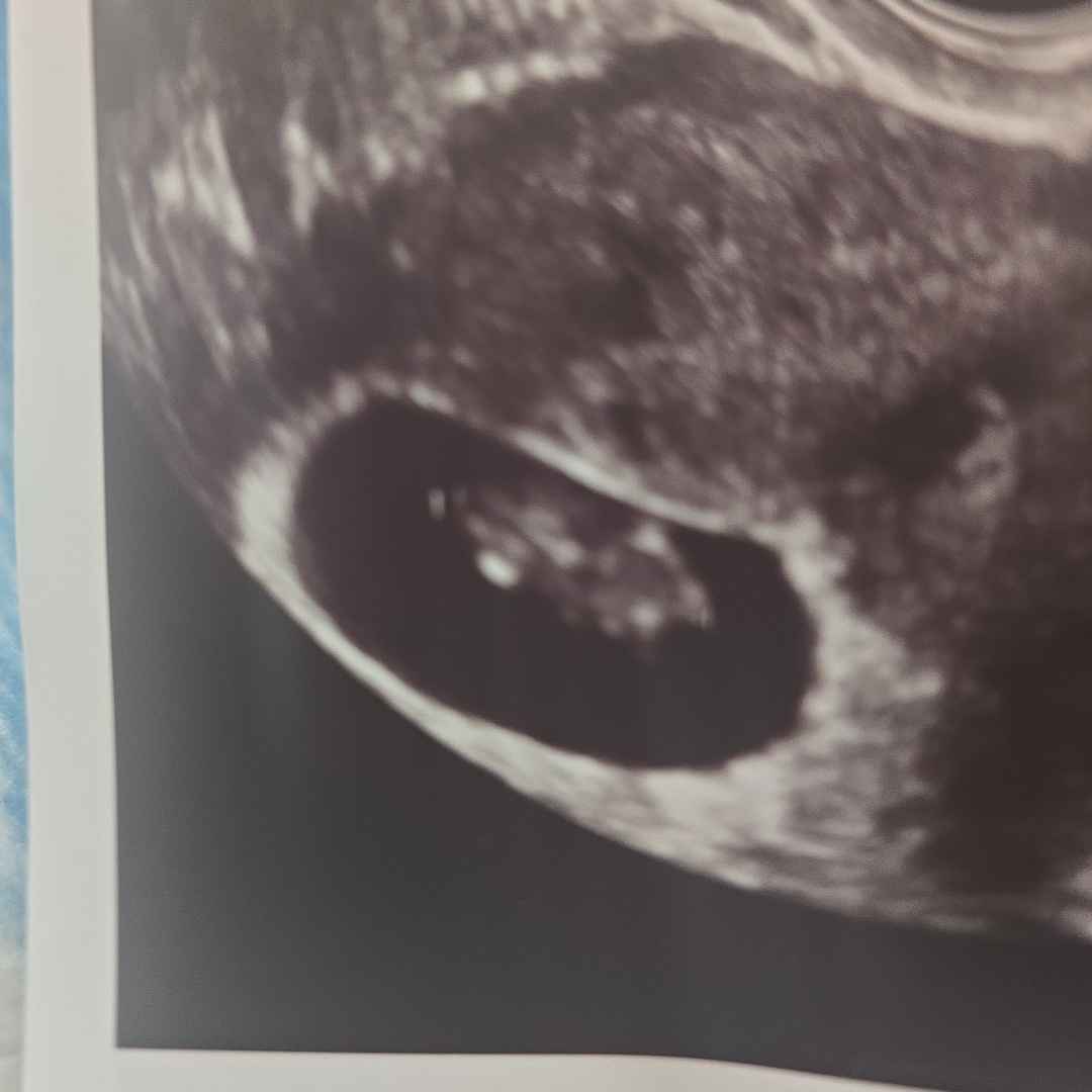 Photo shared by Andre for their Babylist baby registry.