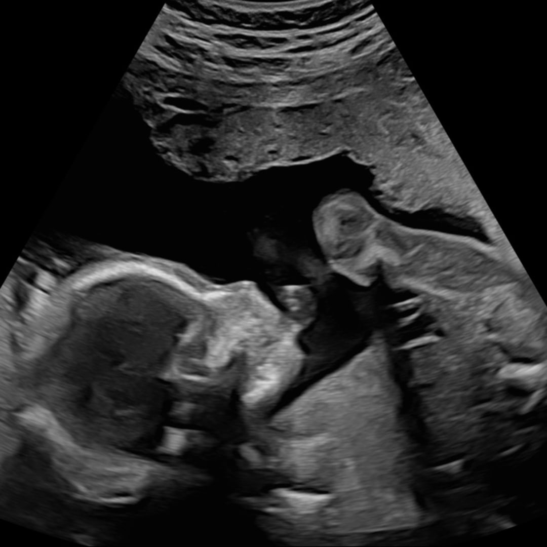 Photo shared by Danielle for their Babylist baby registry.