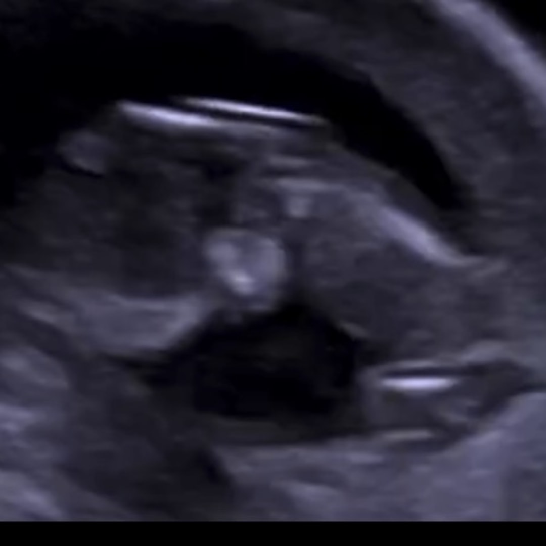 Photo shared by Courtney for their Babylist baby registry.