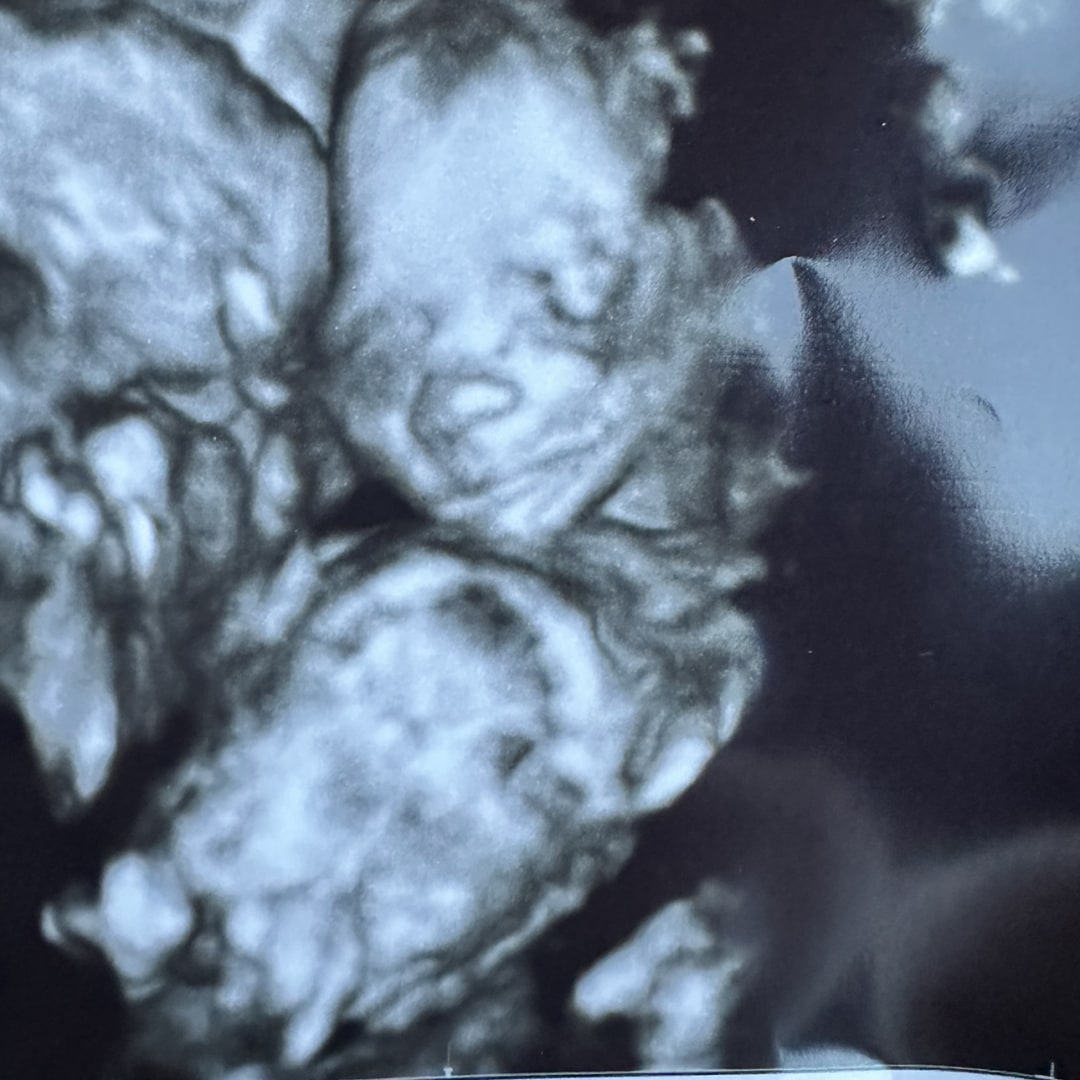 Photo shared by Hannah for their Babylist baby registry.