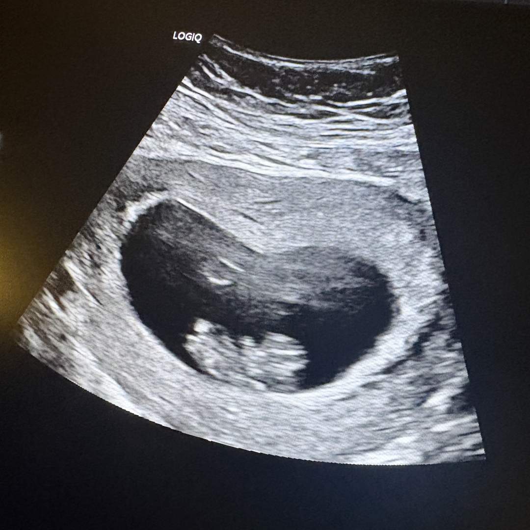 Photo shared by Gabrielle for their Babylist baby registry.