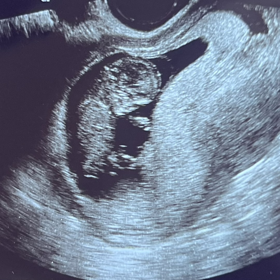 Photo shared by Viviana for their Babylist baby registry.