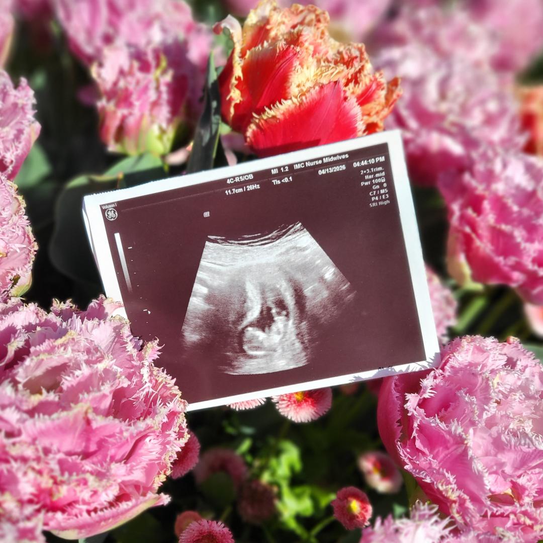Photo shared by B for their Babylist baby registry.