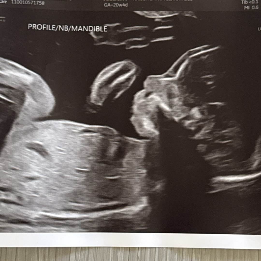 Photo shared by Alannah for their Babylist baby registry.