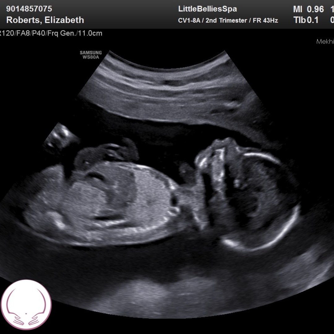 Photo shared by Elizabeth for their Babylist baby registry.