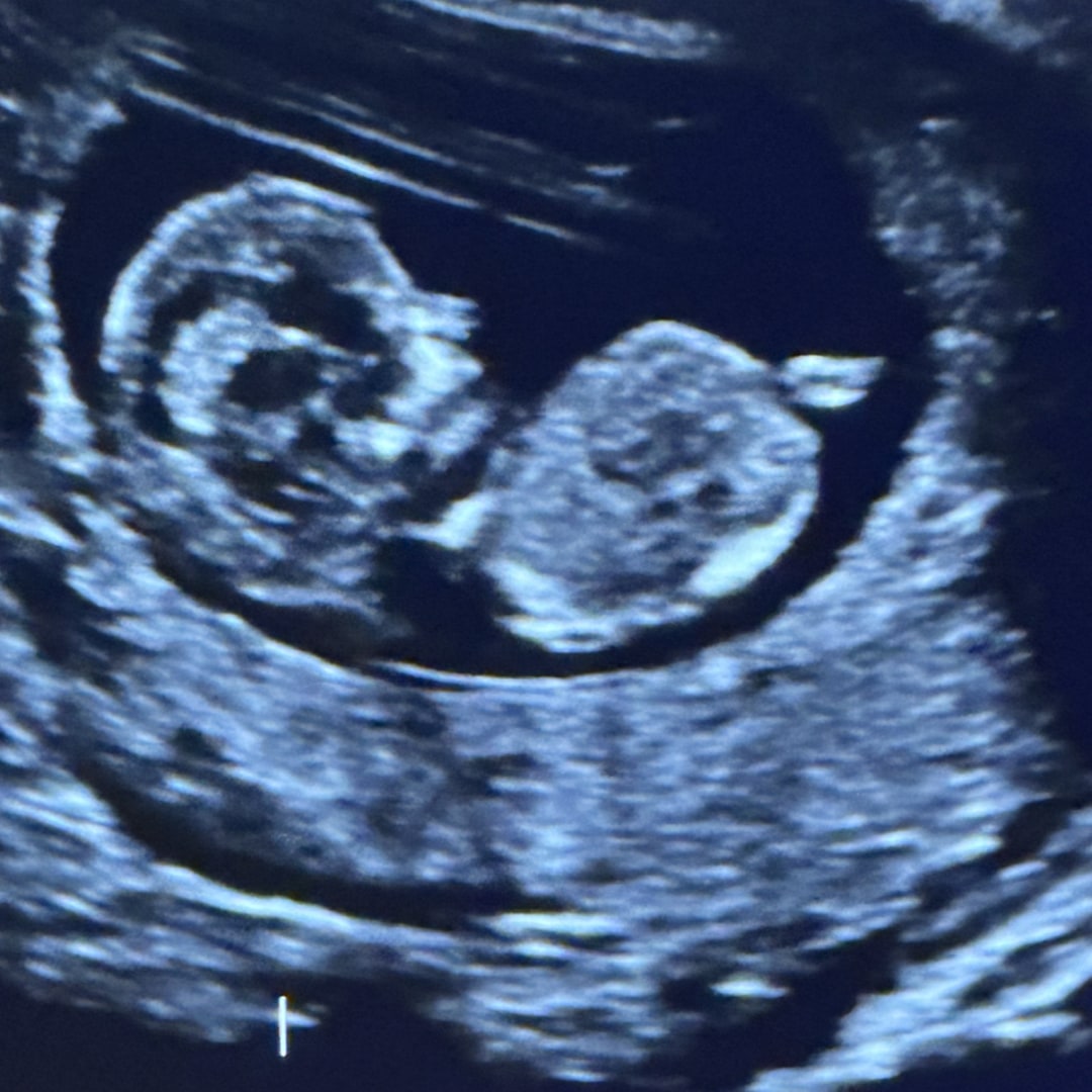 Photo shared by Cristina for their Babylist baby registry.