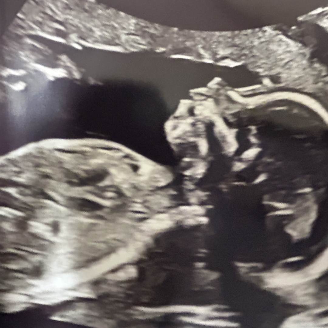 Photo shared by Cymantha for their Babylist baby registry.