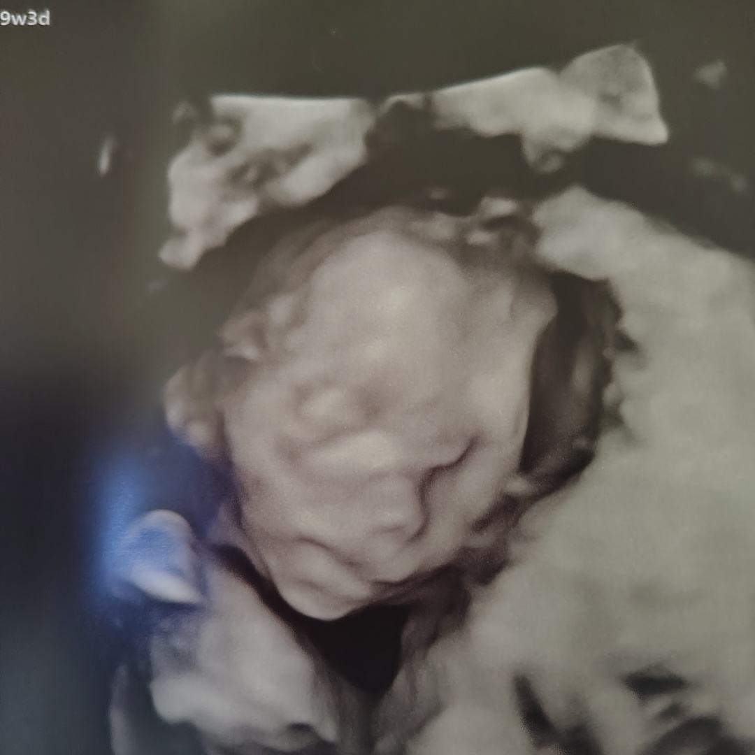Photo shared by Billiejean for their Babylist baby registry.