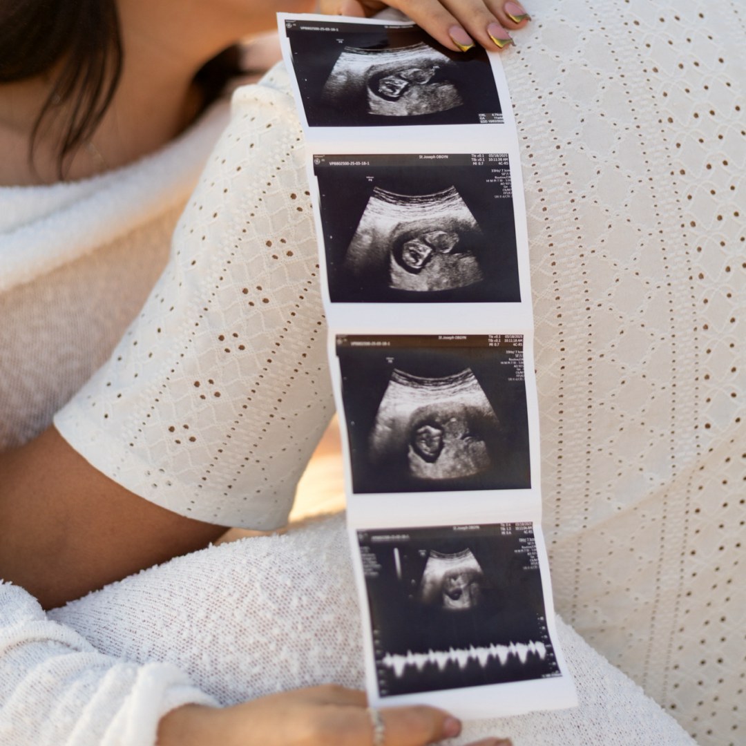 Photo shared by Emily for their Babylist baby registry.