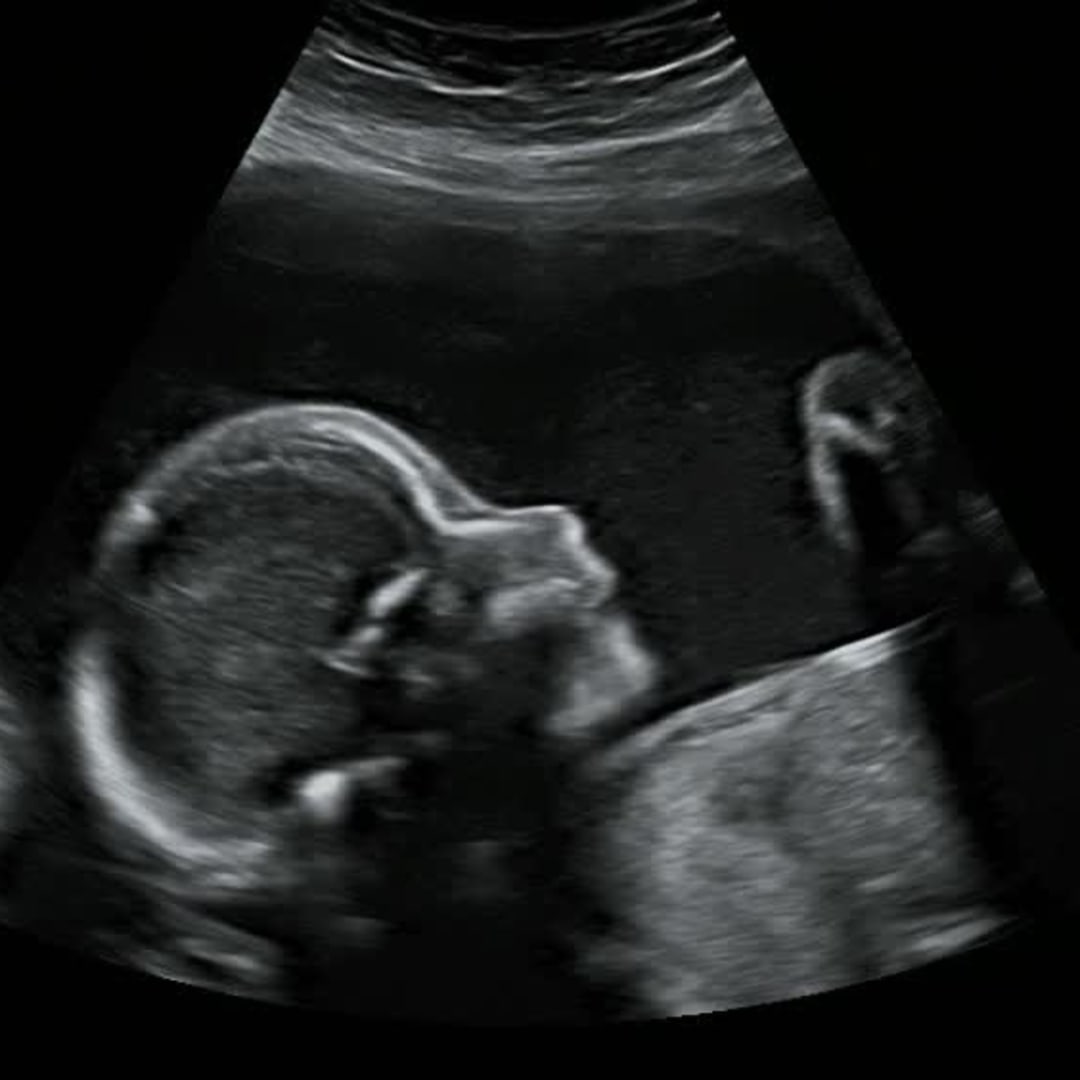 Photo shared by Anna for their Babylist baby registry.