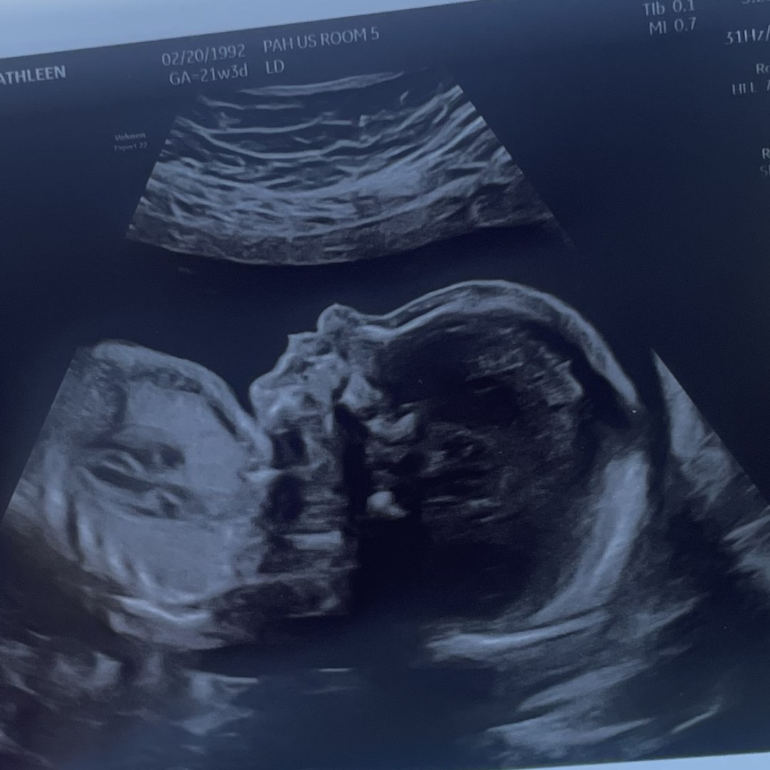 Photo shared by Katie for their Babylist baby registry.