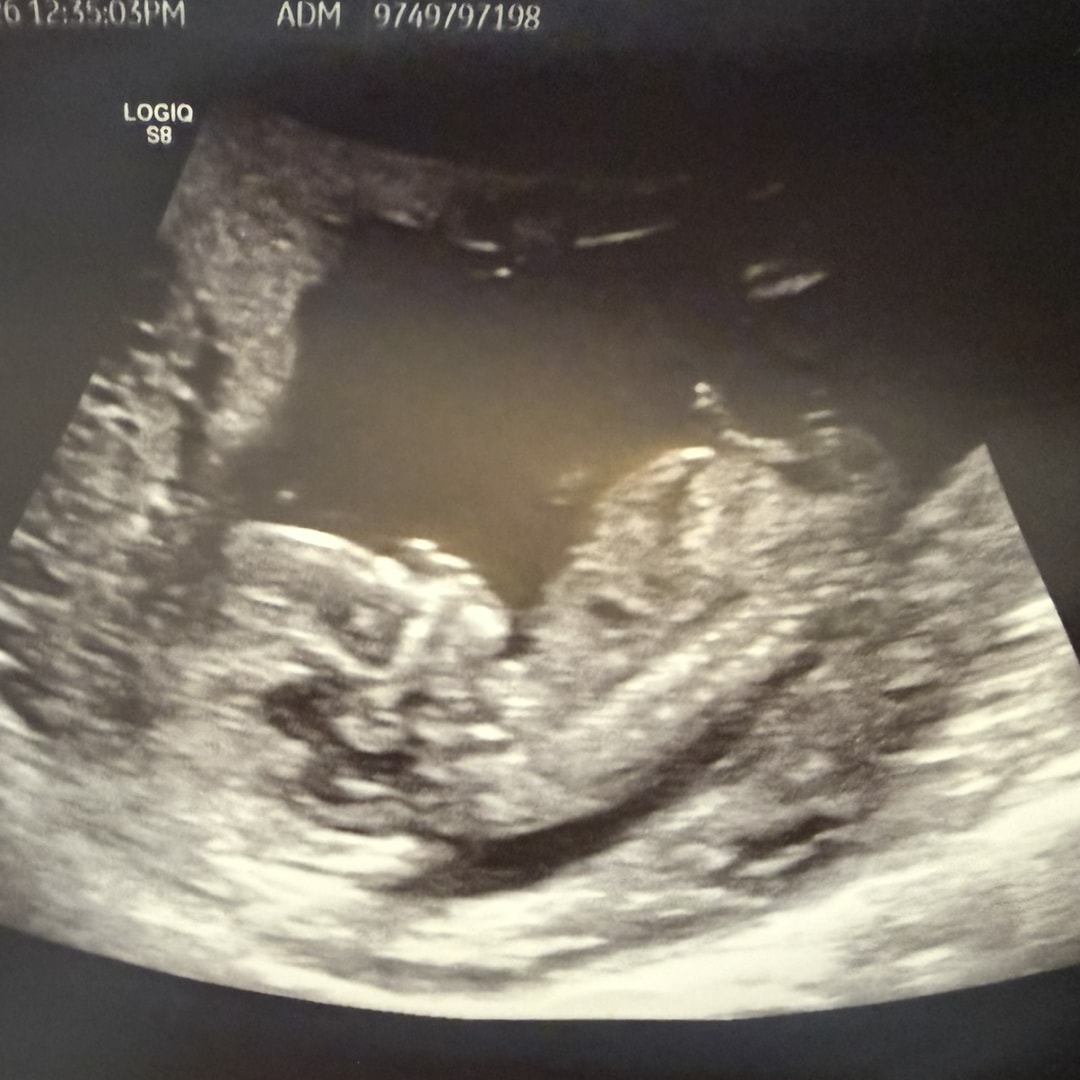 Photo shared by Alexandra for their Babylist baby registry.