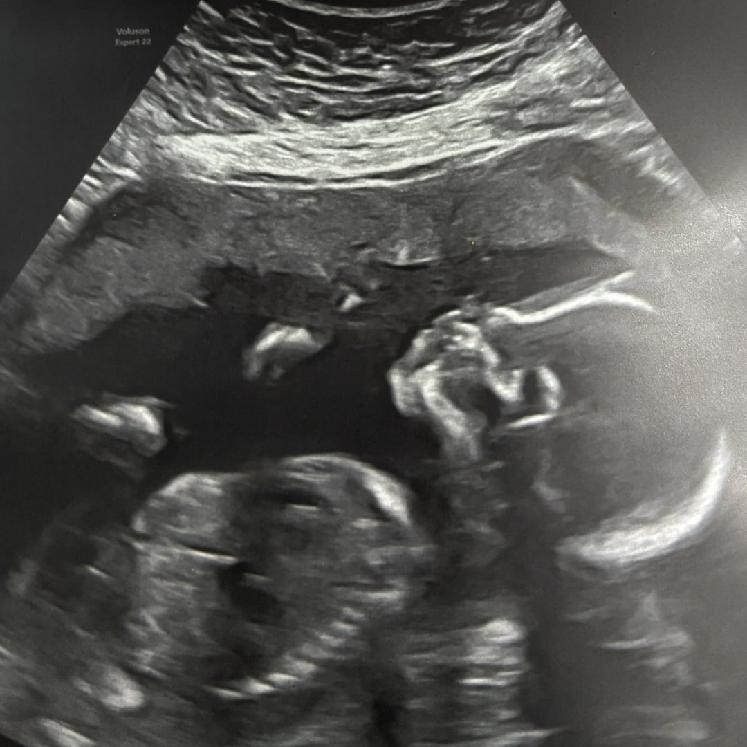 Photo shared by Daniella for their Babylist baby registry.
