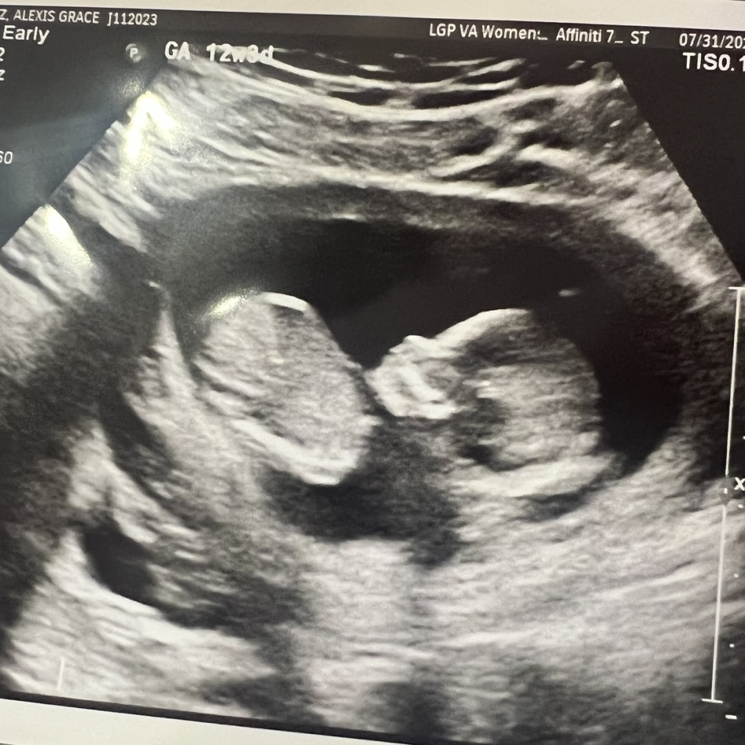 Photo shared by Alexis for their Babylist baby registry.