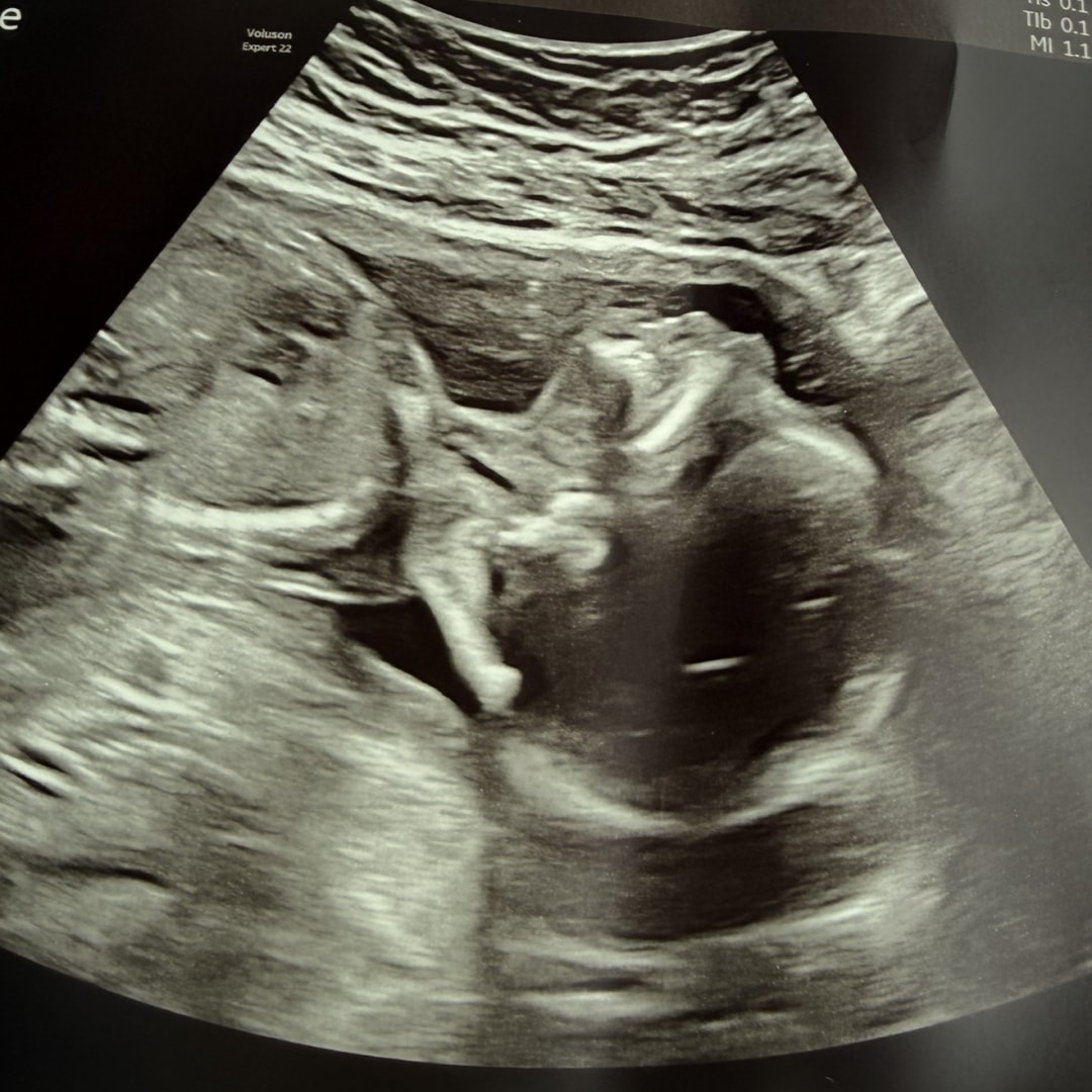 Photo shared by Brooklyn for their Babylist baby registry.