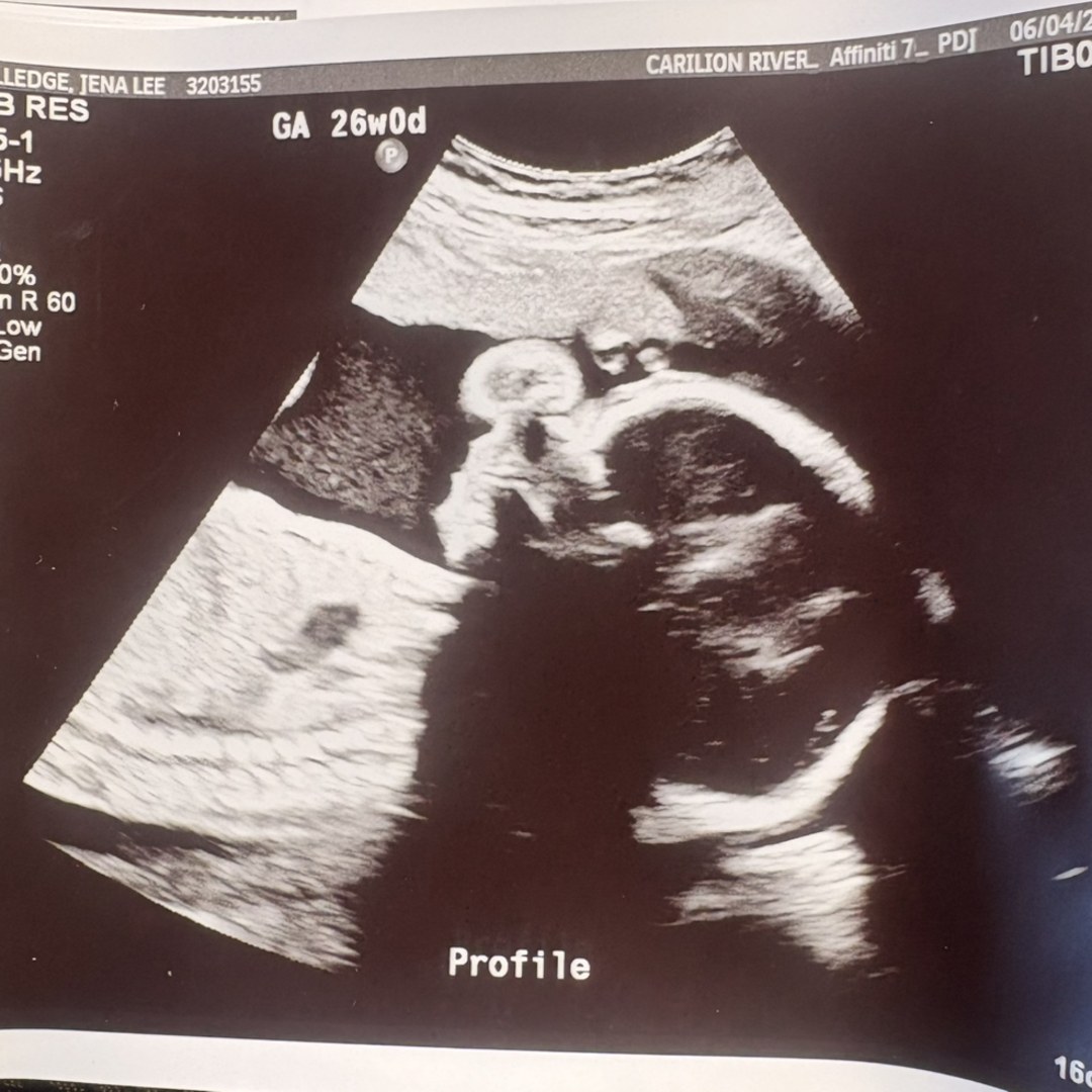 Photo shared by Jena for their Babylist baby registry.
