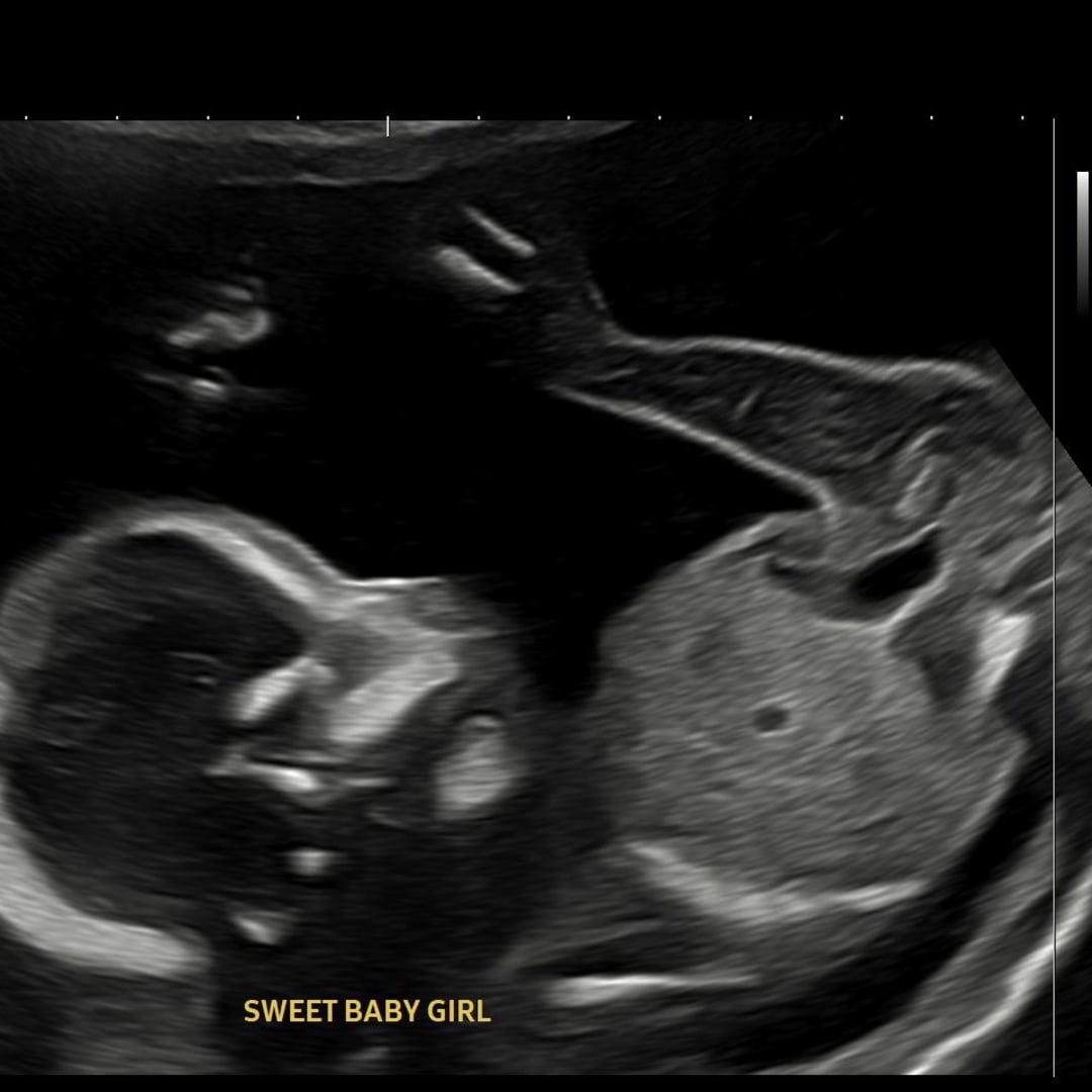 Photo shared by Alicia for their Babylist baby registry.