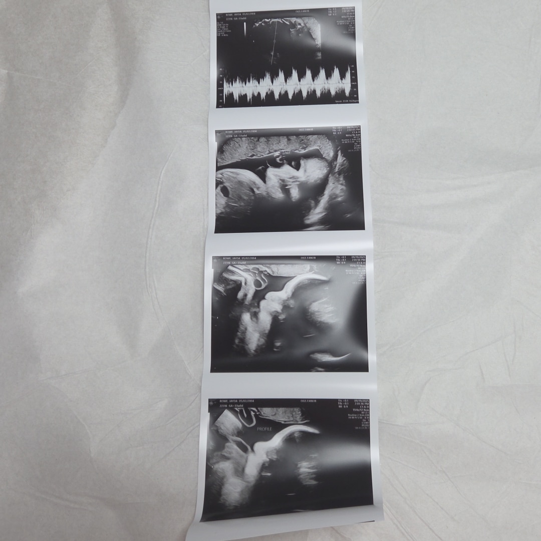 Photo shared by Jayda for their Babylist baby registry.