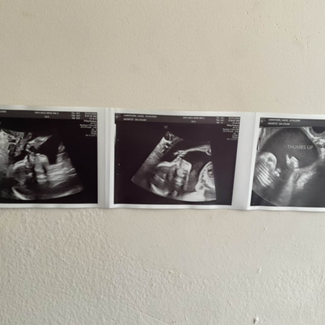 Photo shared by Hazel for their Babylist baby registry.
