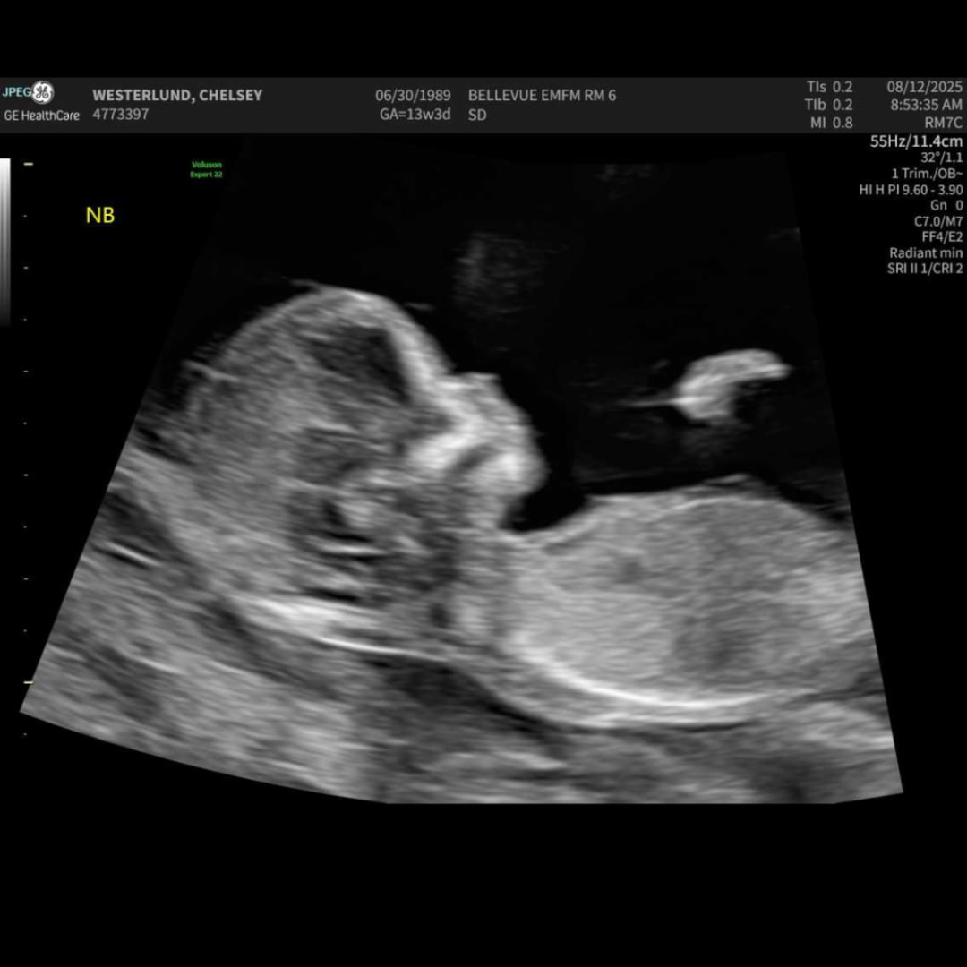Photo shared by Chelsey for their Babylist baby registry.
