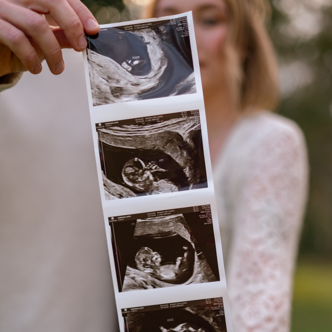 Photo shared by Katie for their Babylist baby registry.