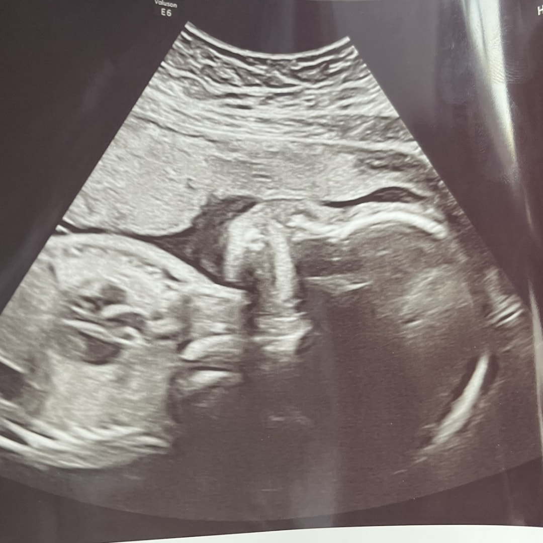 Photo shared by Bella for their Babylist baby registry.