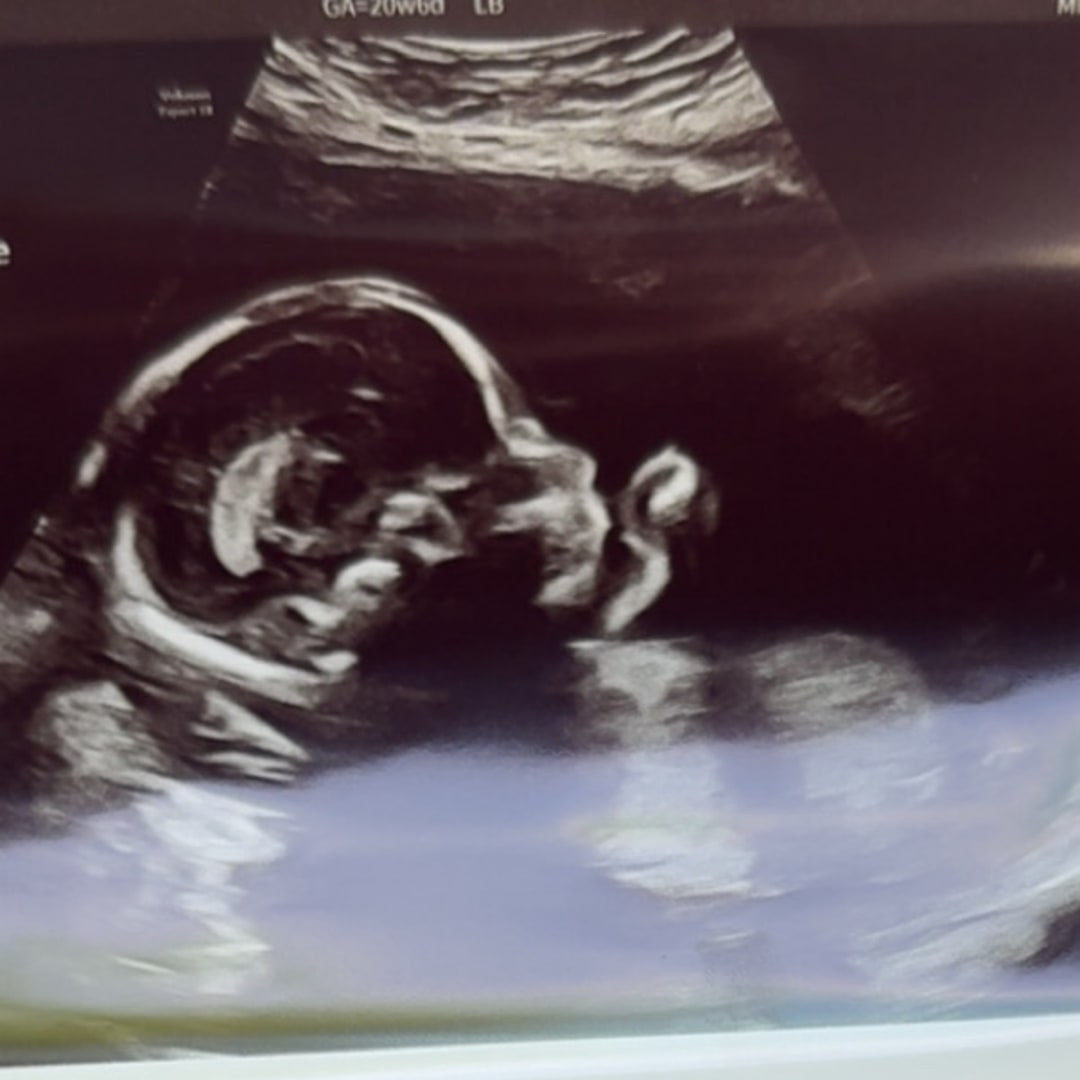Photo shared by Ariel for their Babylist baby registry.