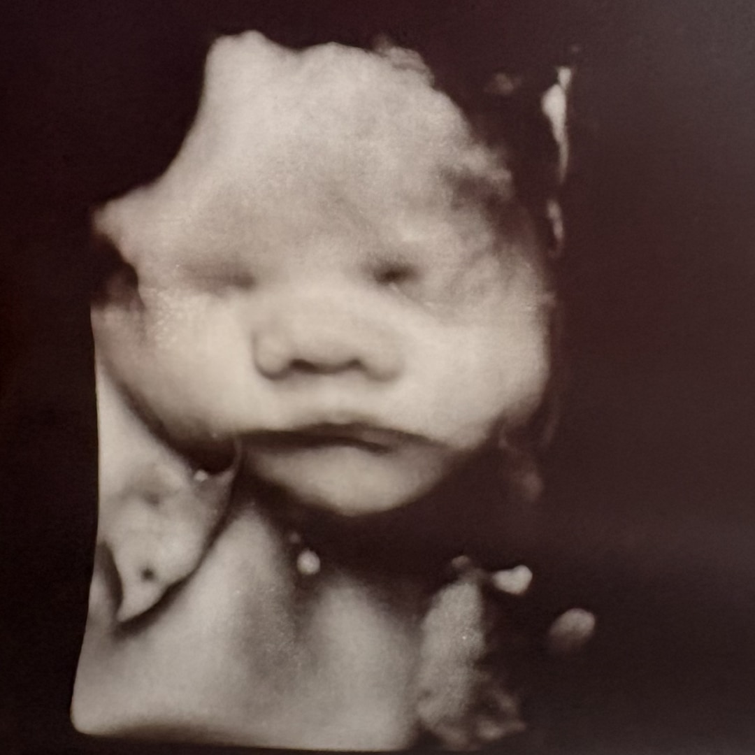 Photo shared by Courtney for their Babylist baby registry.