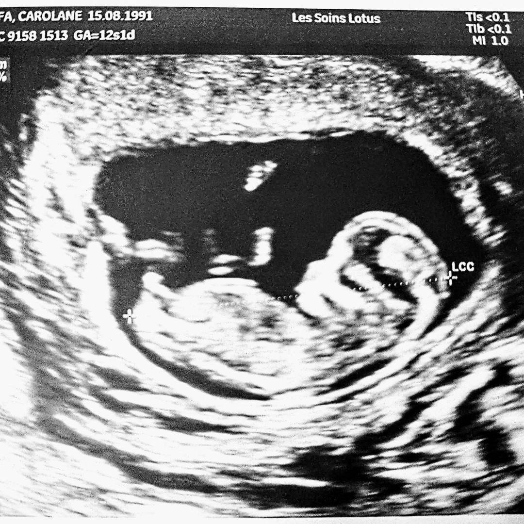 Photo shared by Carolane for their Babylist baby registry.