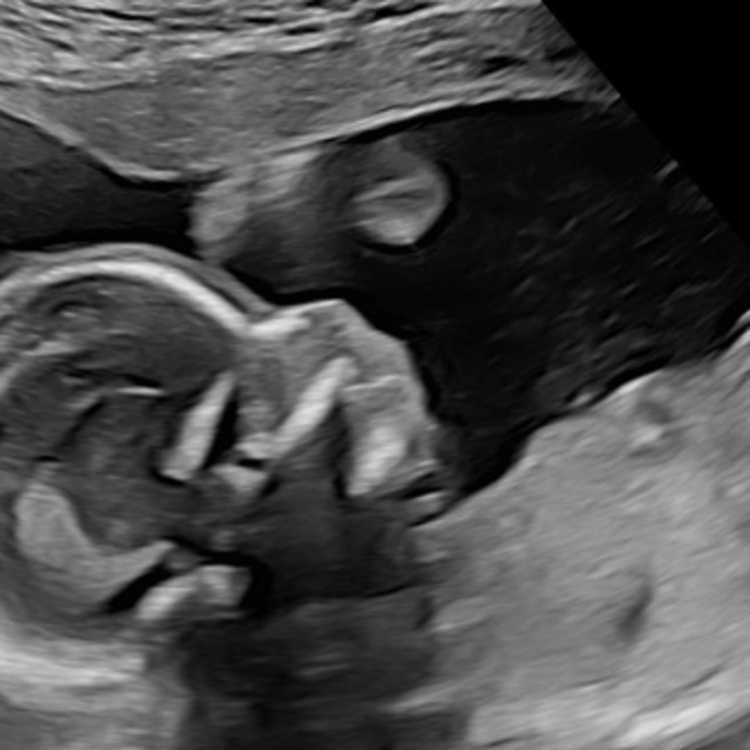 Photo shared by DaCelia for their Babylist baby registry.