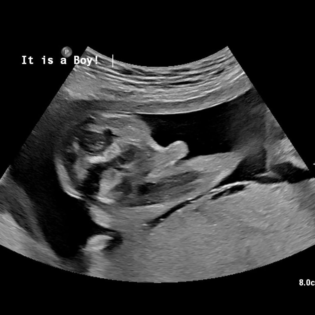 Photo shared by Briona for their Babylist baby registry.
