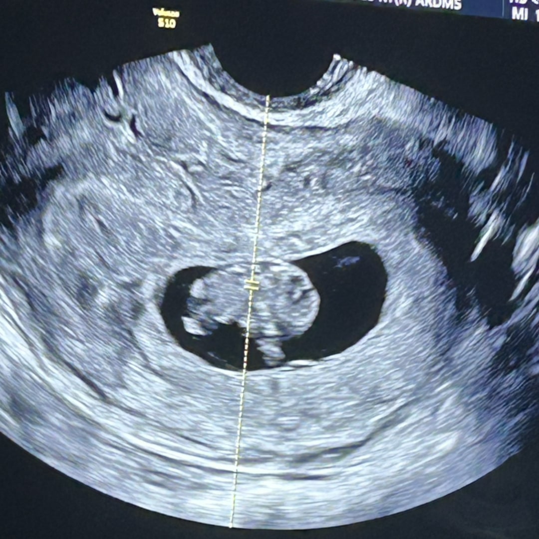 Photo shared by Chelsy for their Babylist baby registry.